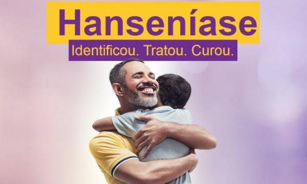 Departamento de Saúde intensifica Campanha de Prevenção a hanseníase